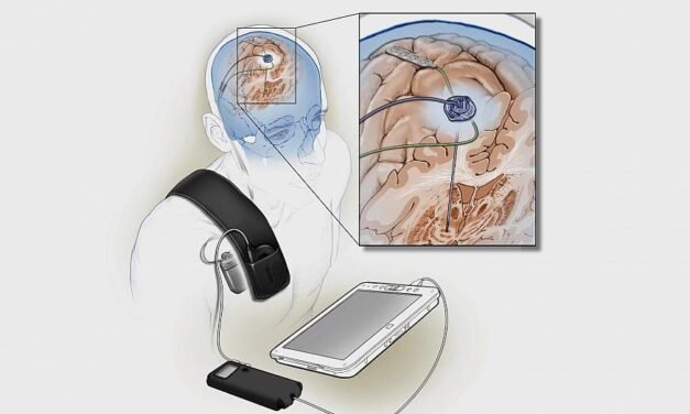 Breakthrough Implantable Device Could Revolutionize Treatment for Parkinson’s Disease